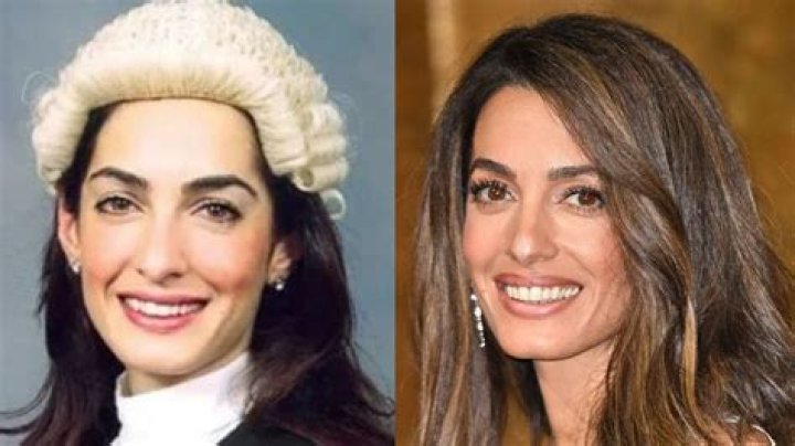Amal Clooney Before Surgery: The Journey of a Human Rights Lawyer and Fashion Icon