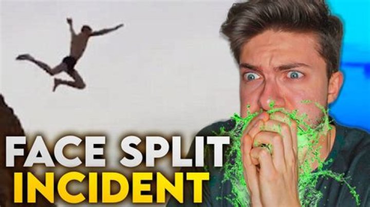 Understanding Face Splitting Diving Accidents: Causes, Prevention, and Recovery