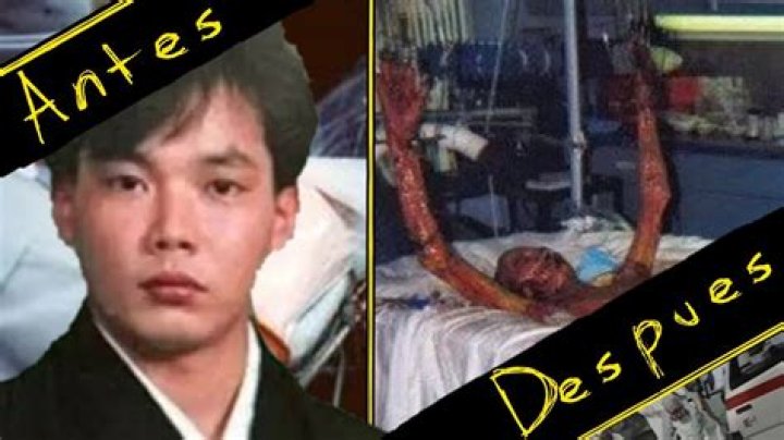Hisashi Ouchi: The Heartbreaking Story Behind the Real Photos from the Hospital