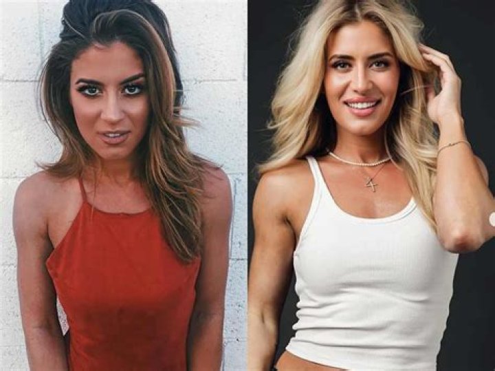 Kendall Toole Breast Implants: Everything You Need to Know