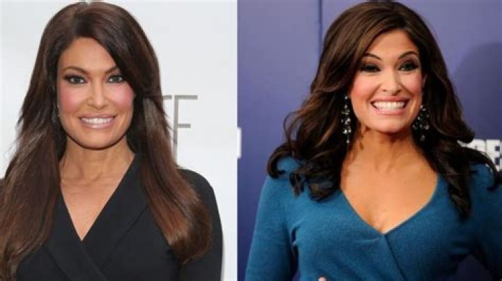 Kimberly Guilfoyle Face Lift: Everything You Need to Know About Her Transformation