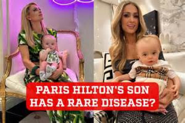 Exploring Paris Hilton's Son's Disease: Understanding the Challenges and Triumphs