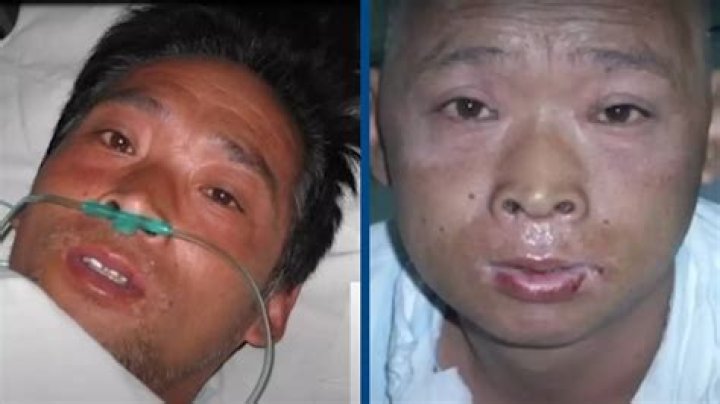 Exploring the Life and Legacy of Hisashi Ouchi: A Glimpse through Pictures