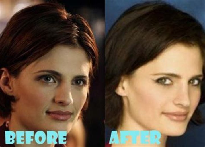 Stana Katic: A Doctor's Journey Beyond Acting